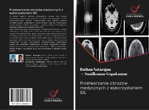 Przetwarzanie obrazów medycznych z wykorzystaniem IDL