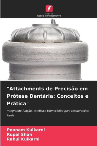 "Attachments de Precisão em Prótese Dentária: Conceitos e Prática"