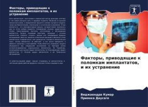 Faktory, priwodqschie k polomkam implantatow, i ih ustranenie