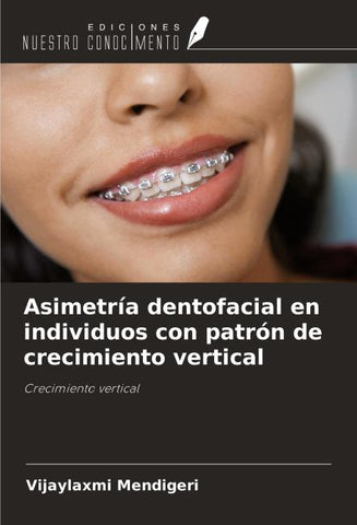 Asimetría dentofacial en individuos con patrón de crecimiento vertical