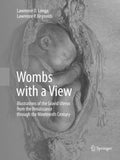 Wombs with a View