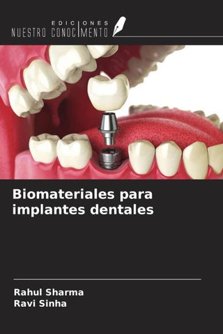 Biomateriales para implantes dentales