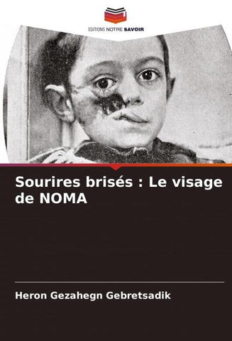 Sourires brisés : Le visage de NOMA