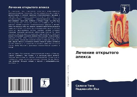 Lechenie otkrytogo apexa