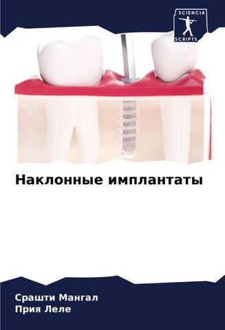 Naklonnye implantaty