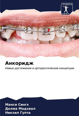 Ankoridzh