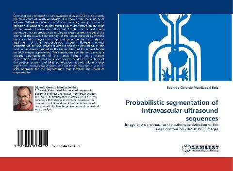 Probabilistic segmentation of intravascular ultrasound sequences
