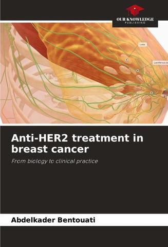 Anti-HER2 treatment in breast cancer