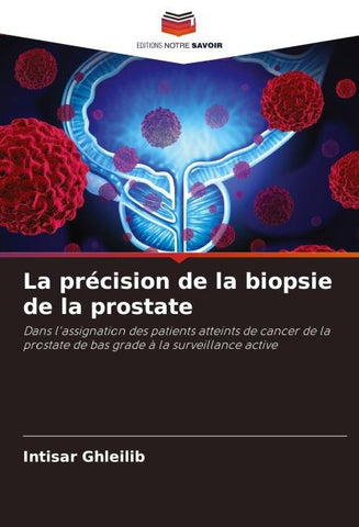 La précision de la biopsie de la prostate