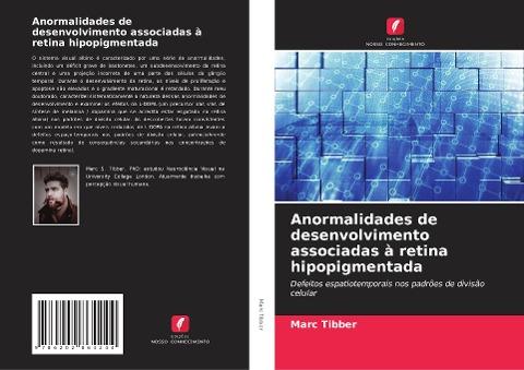 Anormalidades de desenvolvimento associadas à retina hipopigmentada