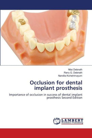 Occlusion for dental implant prosthesis