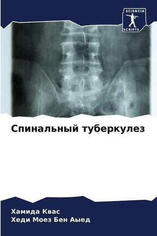 Spinal'nyj tuberkulez