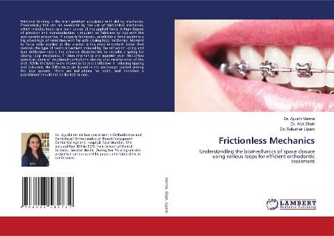 Frictionless Mechanics