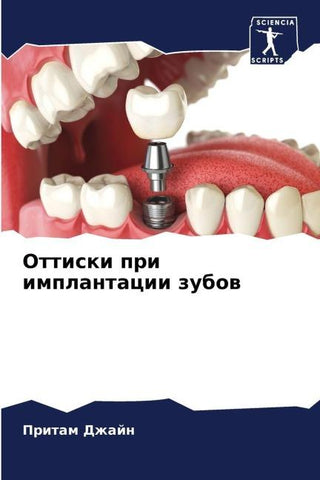 Ottiski pri implantacii zubow