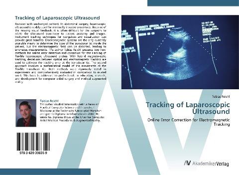 Tracking of Laparoscopic Ultrasound