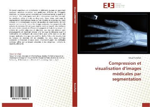 Compression et visualisation d'images médicales par segmentation