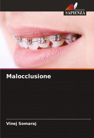 Malocclusione