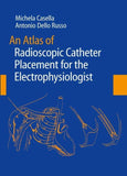 An Atlas of Radioscopic Catheter Placement for the Electrophysiologist