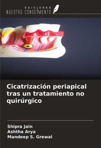 Cicatrización periapical tras un tratamiento no quirúrgico