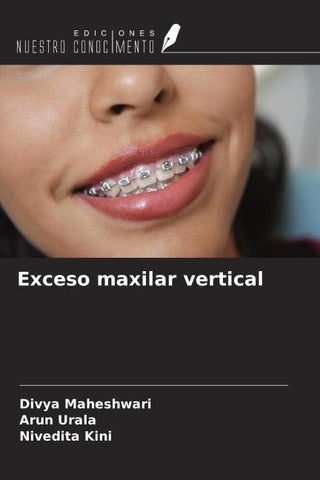 Exceso maxilar vertical