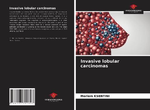 Invasive lobular carcinomas