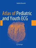 Atlas of Pediatric and Youth ECG