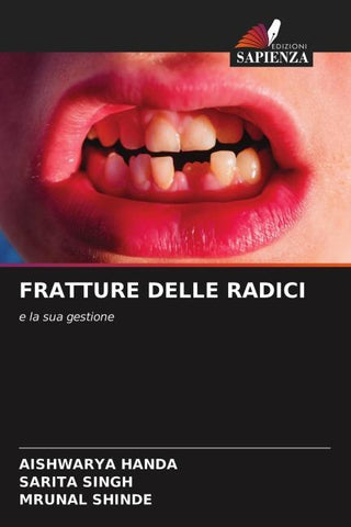 FRATTURE DELLE RADICI