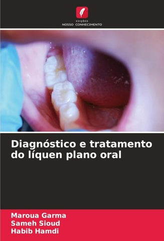 Diagnóstico e tratamento do líquen plano oral