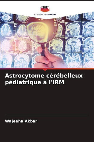 Astrocytome cérébelleux pédiatrique à l'IRM