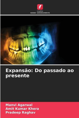 Expansão: Do passado ao presente