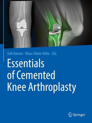 Essentials of Cemented Knee Arthroplasty