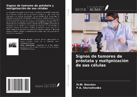 Signos de tumores de próstata y malignización de sus células