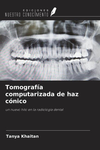 Tomografía computarizada de haz cónico