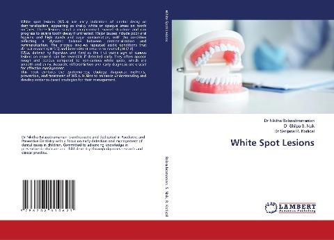 White Spot Lesions