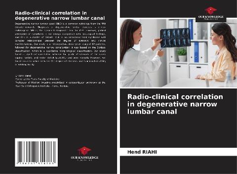 Radio-clinical correlation in degenerative narrow lumbar canal