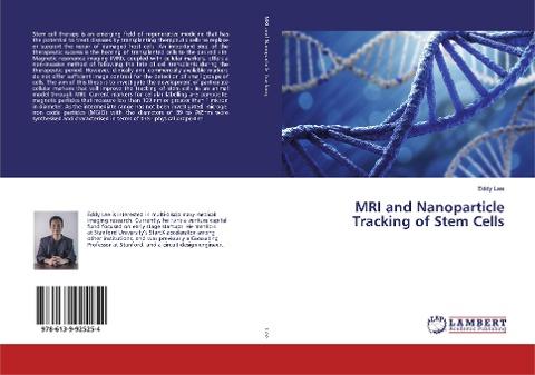 MRI and Nanoparticle Tracking of Stem Cells