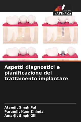 Aspetti diagnostici e pianificazione del trattamento implantare