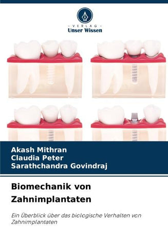 Biomechanik von Zahnimplantaten