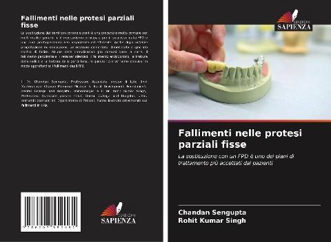 Fallimenti nelle protesi parziali fisse