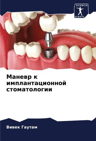 Manewr k implantacionnoj stomatologii