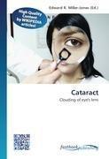 Cataract