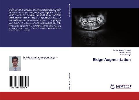 Ridge Augmentation