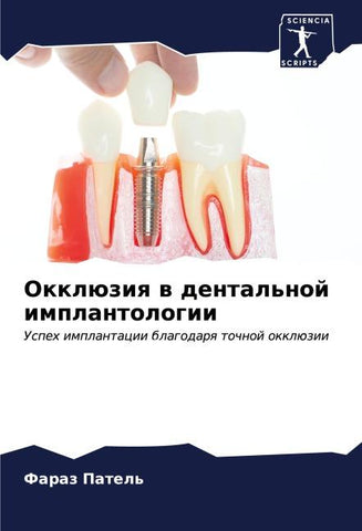 Okklüziq w dental'noj implantologii