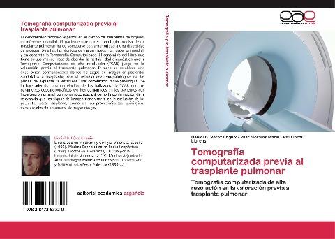Tomografía computarizada previa al trasplante pulmonar