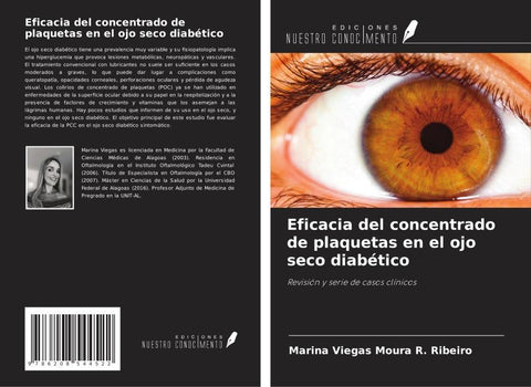 Eficacia del concentrado de plaquetas en el ojo seco diabético