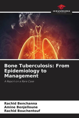 Bone Tuberculosis: From Epidemiology to Management