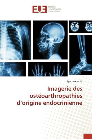 Imagerie des ostéoarthropathies d'origine endocrinienne