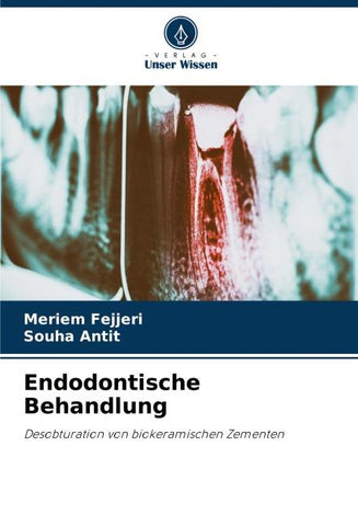 Endodontische Behandlung