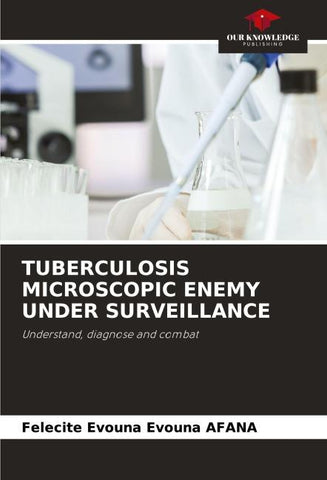 TUBERCULOSIS MICROSCOPIC ENEMY UNDER SURVEILLANCE
