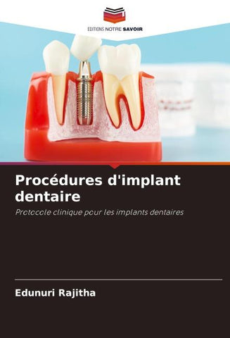 Procédures d'implant dentaire